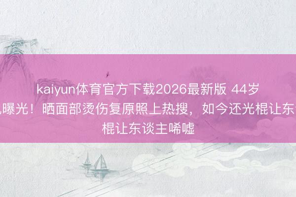 kaiyun体育官方下载2026最新版 44岁杨蓉近况曝光！晒面部烫伤复原照上热搜，如今还光棍让东谈主唏嘘
